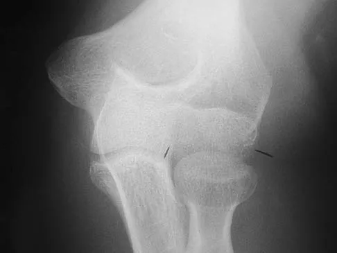 Anatomy 2005 Practice Questions: Set 1 (Solved) - Figure 32