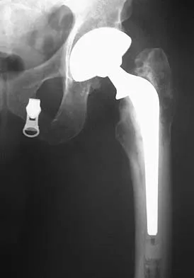 Anatomy 2005 Practice Questions: Set 1 (Solved) - Figure 4