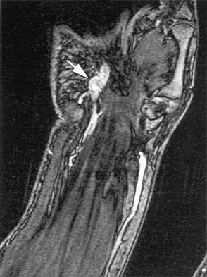 AAOS, ABOS & OITE Anatomy MCQs (Set 2): High-Yield Skeletal, Joint & Muscle Systems