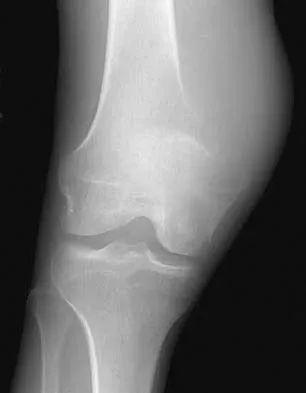Anatomy Board Review 2005: High-Yield MCQs (Set 2) - Figure 12