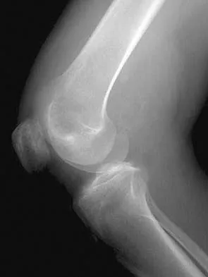 Anatomy Board Review 2005: High-Yield MCQs (Set 2) - Figure 13