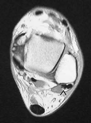 Anatomy Board Review 2005: High-Yield MCQs (Set 2) - Figure 21