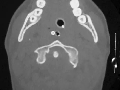 Anatomy Board Review 2005: High-Yield MCQs (Set 2) - Figure 25