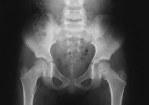 Anatomy Board Review 2005: High-Yield MCQs (Set 2) - Figure 28