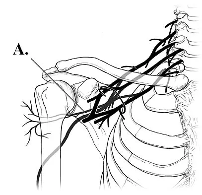 Click to enlarge Anatomy Board Review 2005: High-Yield MCQs (Set 2) - Figure 3