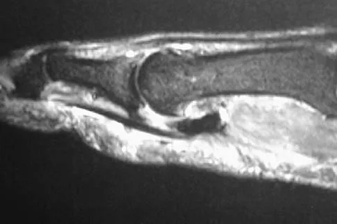 Anatomy Board Review 2005: High-Yield MCQs (Set 2) - Figure 31