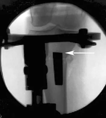Anatomy Board Review 2005: High-Yield MCQs (Set 2) - Figure 5