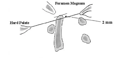 Anatomy Board Review 2005: High-Yield MCQs (Set 2) - Figure 8