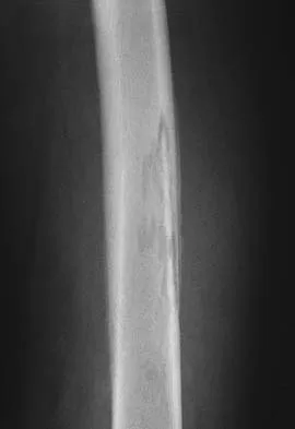 Anatomy 2005 Practice Questions: Set 3 (Solved) - Figure 10