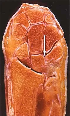 Anatomy 2005 Practice Questions: Set 3 (Solved) - Figure 23