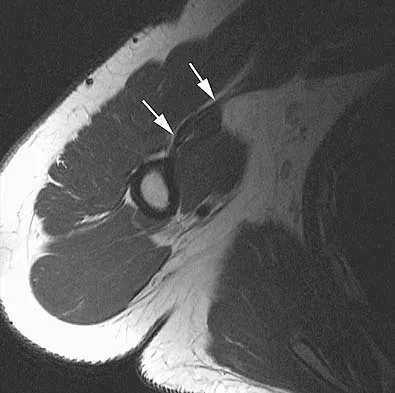 Anatomy 2005 Practice Questions: Set 3 (Solved) - Figure 6