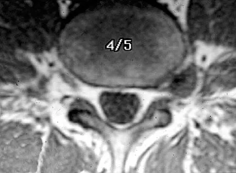 Click to enlarge Anatomy Board Review 2005: High-Yield MCQs (Set 4) - Figure 15