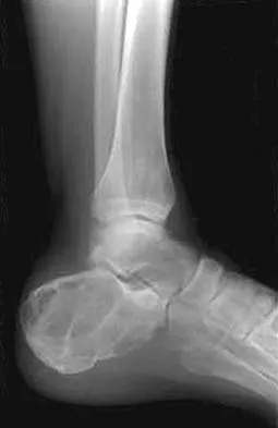 Anatomy Board Review 2005: High-Yield MCQs (Set 4) - Figure 17
