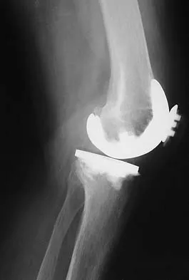 Anatomy Board Review 2005: High-Yield MCQs (Set 4) - Figure 21