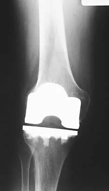 Anatomy Board Review 2005: High-Yield MCQs (Set 4) - Figure 22