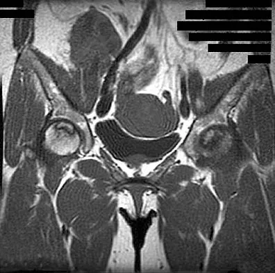 Anatomy Board Review 2005: High-Yield MCQs (Set 4) - Figure 3