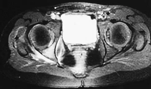 Anatomy Board Review 2005: High-Yield MCQs (Set 4) - Figure 8