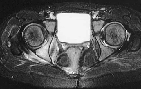 Anatomy Board Review 2005: High-Yield MCQs (Set 4) - Figure 9