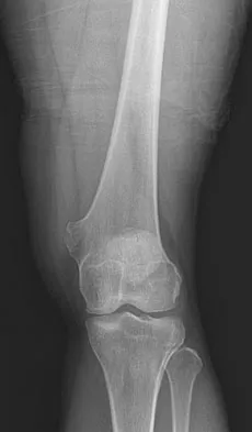 Anatomy 2008 Practice Questions: Set 1 (Solved) - Figure 31