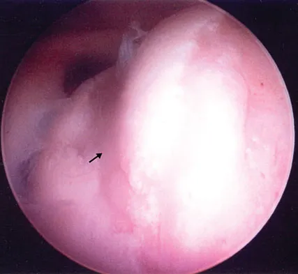 Anatomy 2008 Practice Questions: Set 1 (Solved) - Figure 7