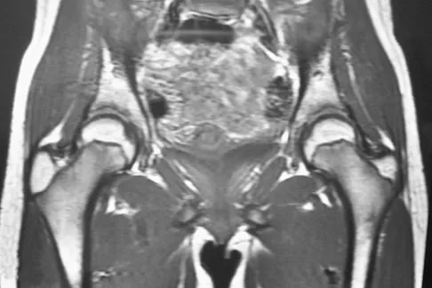 Anatomy 2008 Practice Questions: Set 1 (Solved) - Figure 8