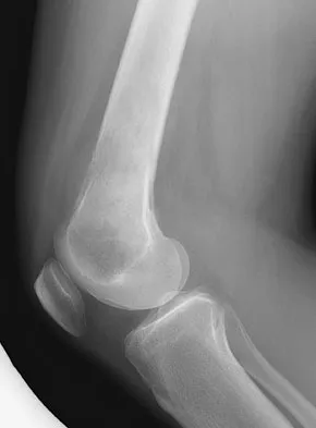 Anatomy Board Review 2008: High-Yield MCQs (Set 2) - Figure 12