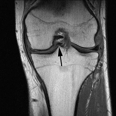 Anatomy Board Review 2008: High-Yield MCQs (Set 2) - Figure 14
