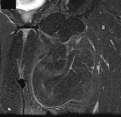 Anatomy Board Review 2008: High-Yield MCQs (Set 2) - Figure 22