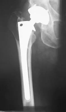 Anatomy Board Review 2008: High-Yield MCQs (Set 2) - Figure 26