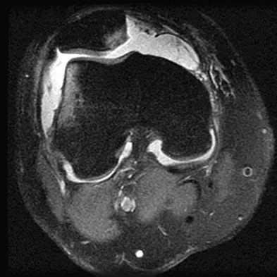 Anatomy Board Review 2008: High-Yield MCQs (Set 2) - Figure 40