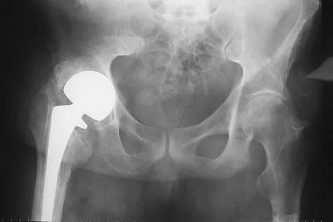 Anatomy Board Review 2008: High-Yield MCQs (Set 2) - Figure 41