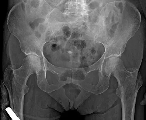 Anatomy Board Review 2008: High-Yield MCQs (Set 2) - Figure 5