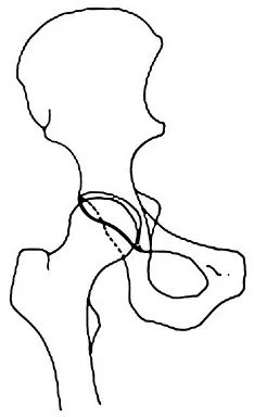 Anatomy 2008 Practice Questions: Set 3 (Solved) - Figure 11