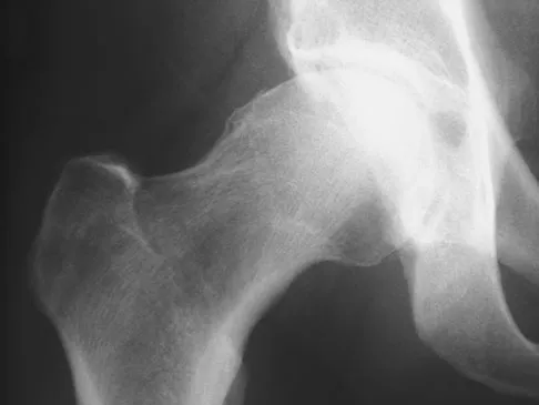 Anatomy 2008 Practice Questions: Set 3 (Solved) - Figure 12