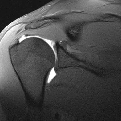 Anatomy 2008 Practice Questions: Set 3 (Solved) - Figure 19