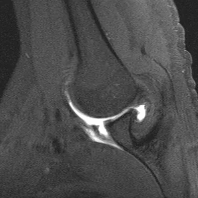 Anatomy 2008 Practice Questions: Set 3 (Solved) - Figure 22