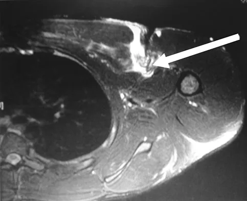 Anatomy 2008 Practice Questions: Set 3 (Solved) - Figure 23
