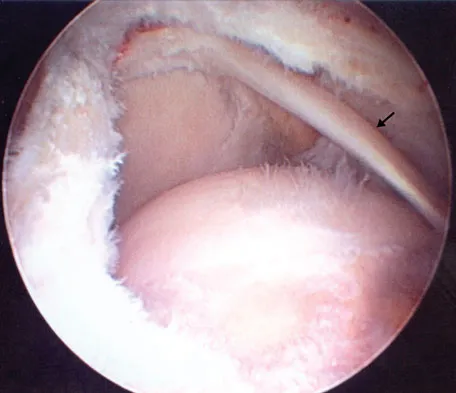 Anatomy 2008 Practice Questions: Set 3 (Solved) - Figure 26