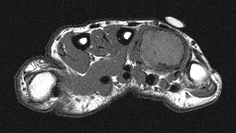 Anatomy 2008 Practice Questions: Set 3 (Solved) - Figure 5