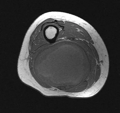 Anatomy Board Review 2008: High-Yield MCQs (Set 4) - Figure 1