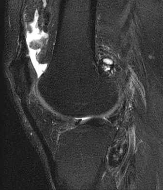 Anatomy Board Review 2008: High-Yield MCQs (Set 4) - Figure 12