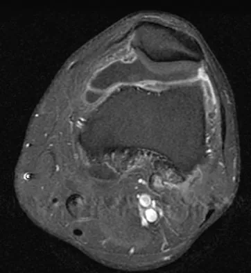 Anatomy Board Review 2008: High-Yield MCQs (Set 4) - Figure 13