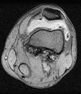 Anatomy Board Review 2008: High-Yield MCQs (Set 4) - Figure 14