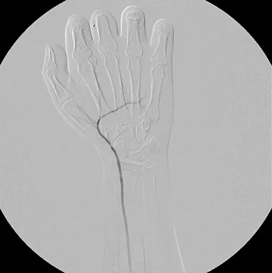 Anatomy Board Review 2008: High-Yield MCQs (Set 4) - Figure 21