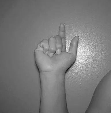 Anatomy Board Review 2008: High-Yield MCQs (Set 4) - Figure 23