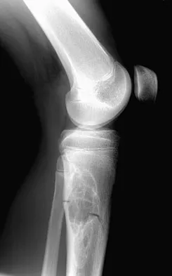 Anatomy Board Review 2008: High-Yield MCQs (Set 4) - Figure 8