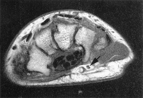 Anatomy 2026 MCQs: Board Review Questions & Answers (Part 1) - Figure 103