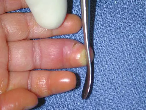 Anatomy 2026 MCQs: Board Review Questions & Answers (Part 1) - Figure 121