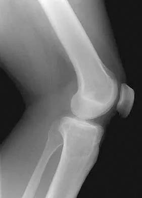 Anatomy 2026 MCQs: Board Review Questions & Answers (Part 1) - Figure 125