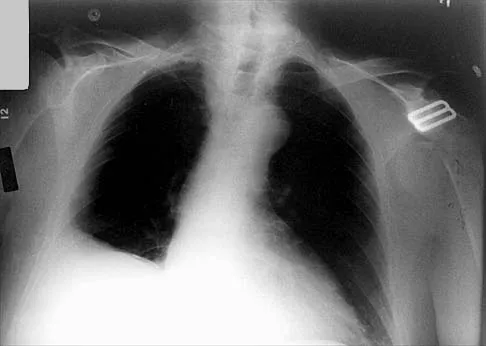 Anatomy 2026 MCQs: Board Review Questions & Answers (Part 1) - Figure 49